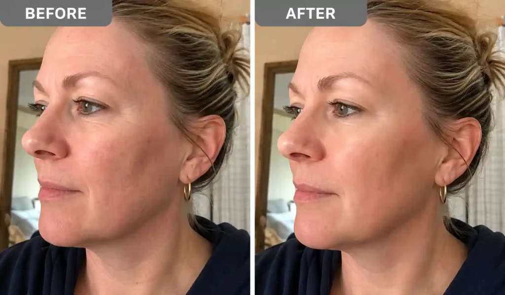 Elesse Cream Verwendung