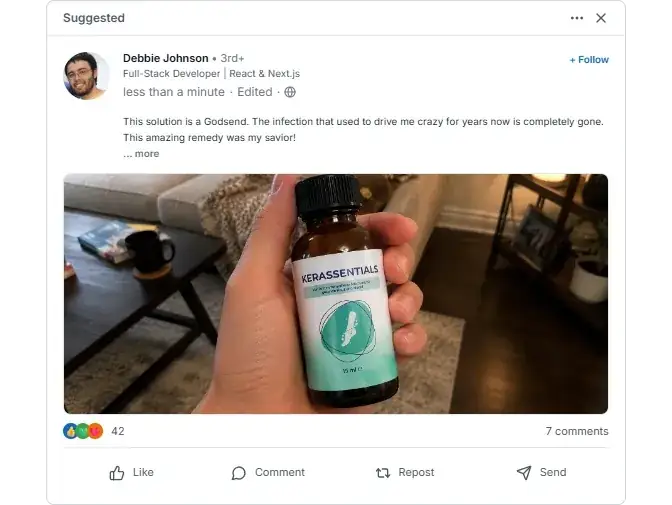Kerassentials Linekdln Reviews