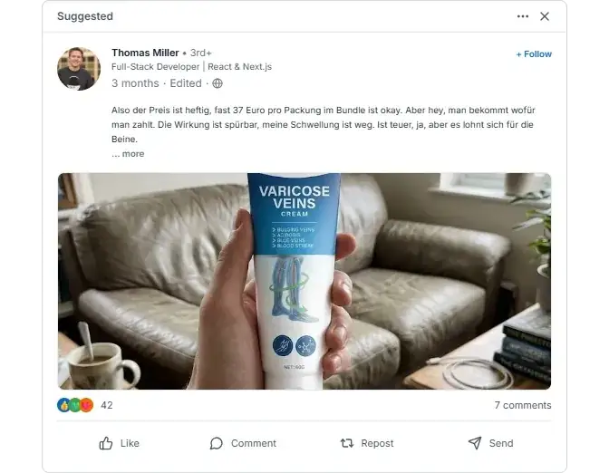 Venorela Varicose Veins Linkedln Bewertungen